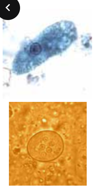 <p>Harmless commensal (symbiotic), must be differentiated from pathogens. Morphology - Trophozoites are 10-35 microns, Cysts 10-30 (w/ 8-16 nuclei). Nucleus exhibits and eccentric karyosome with irregular coarse chromatin. Cytoplasm is vacuolated, w/ yeast, bacteria and debris.</p>