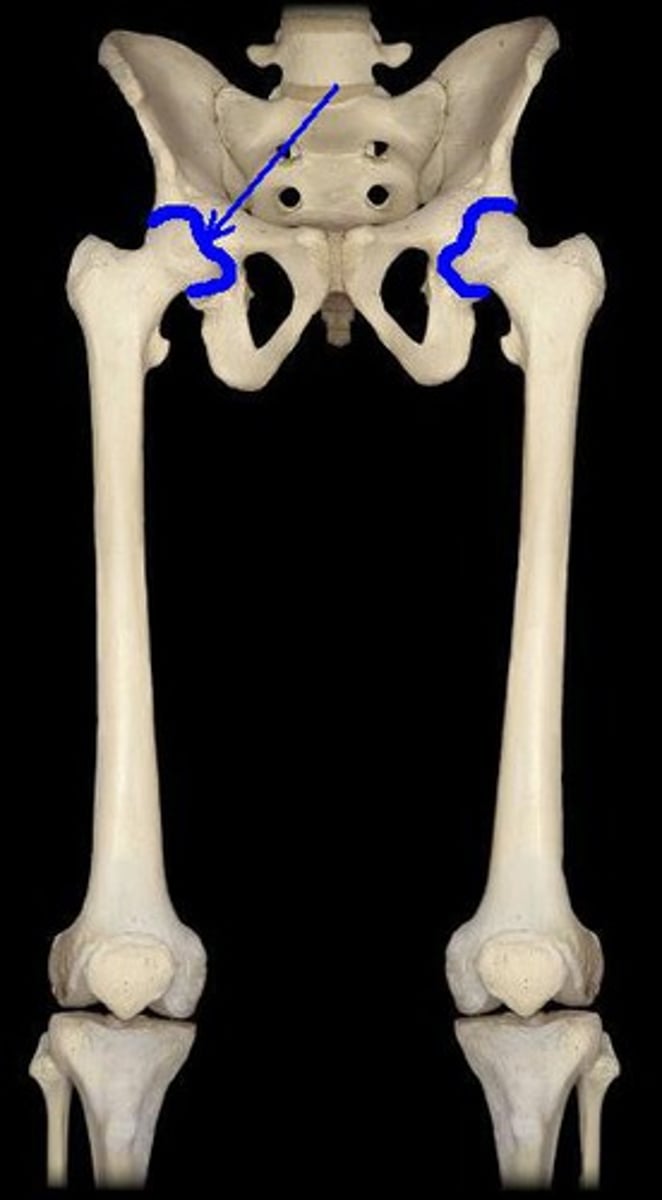 <p>head of femur &amp; acetabulum of innominate bone</p>