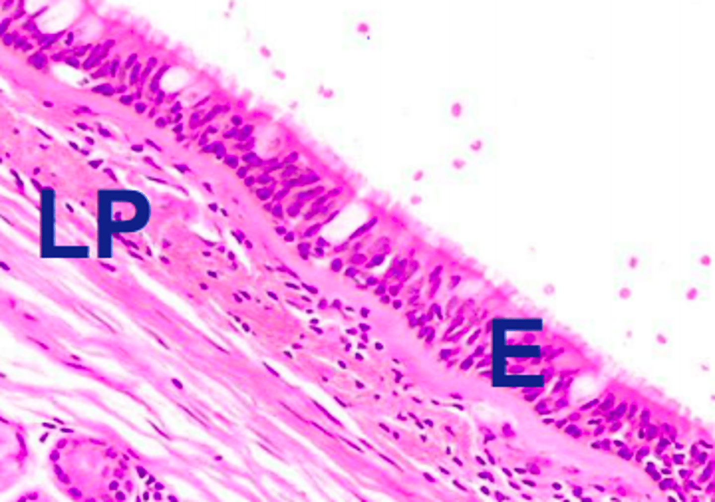 <p>Pseudostratified ciliated columnar epithelium</p>