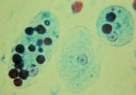<ul><li><p>15-25 um</p></li><li><p>single bull’s eye nucleus with central karyosome</p></li><li><p>can contain ingested RBCs</p></li></ul><p></p>