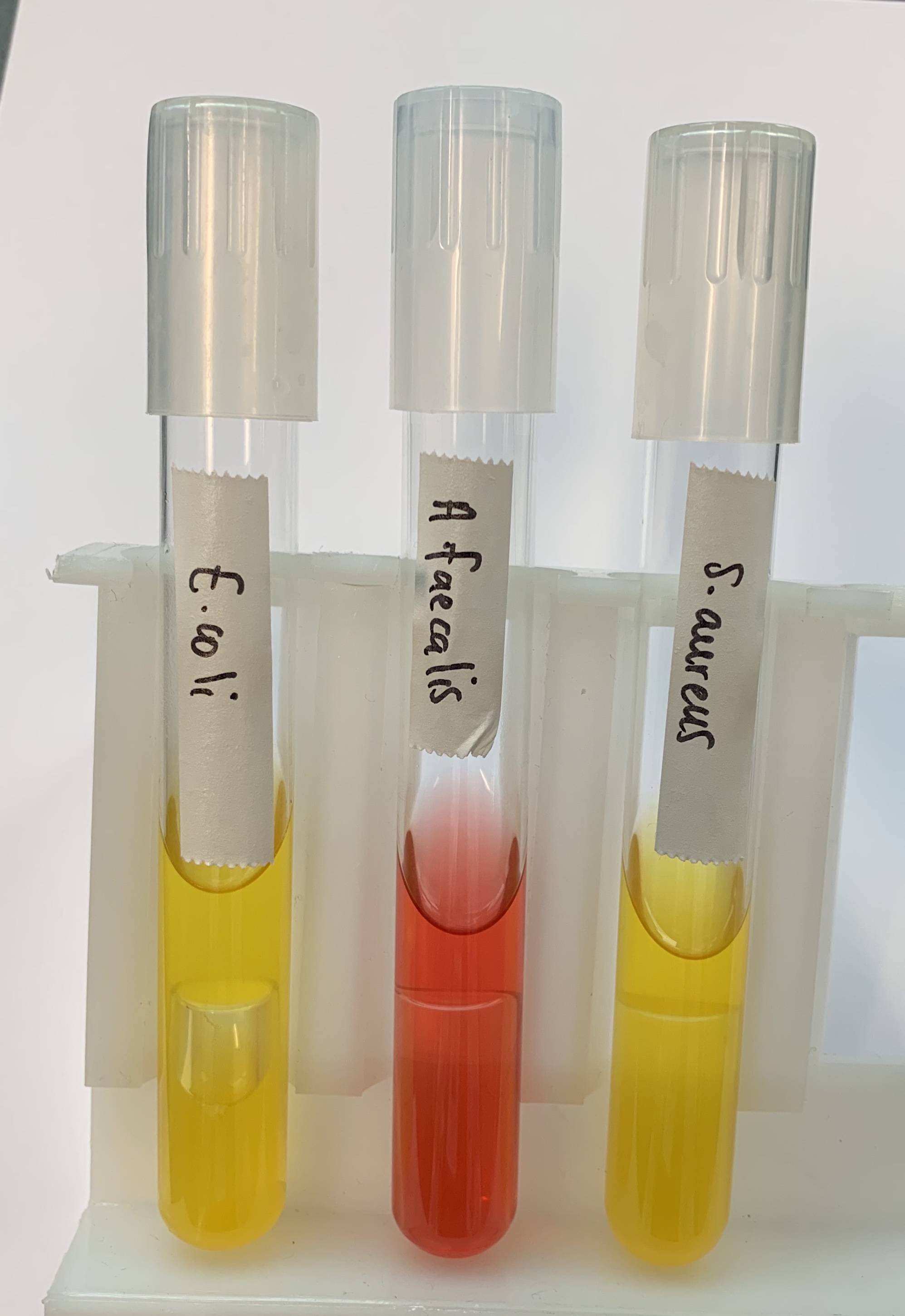 <p>#13 Fermentation of Carbohydrates</p>