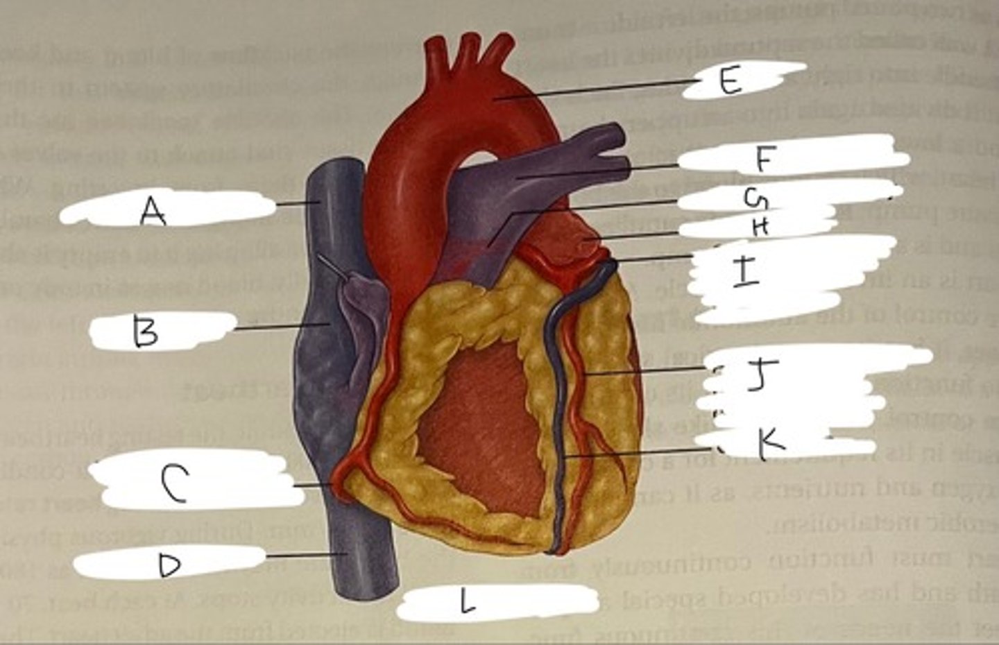 <p>what view of the heart is this? (L)</p>
