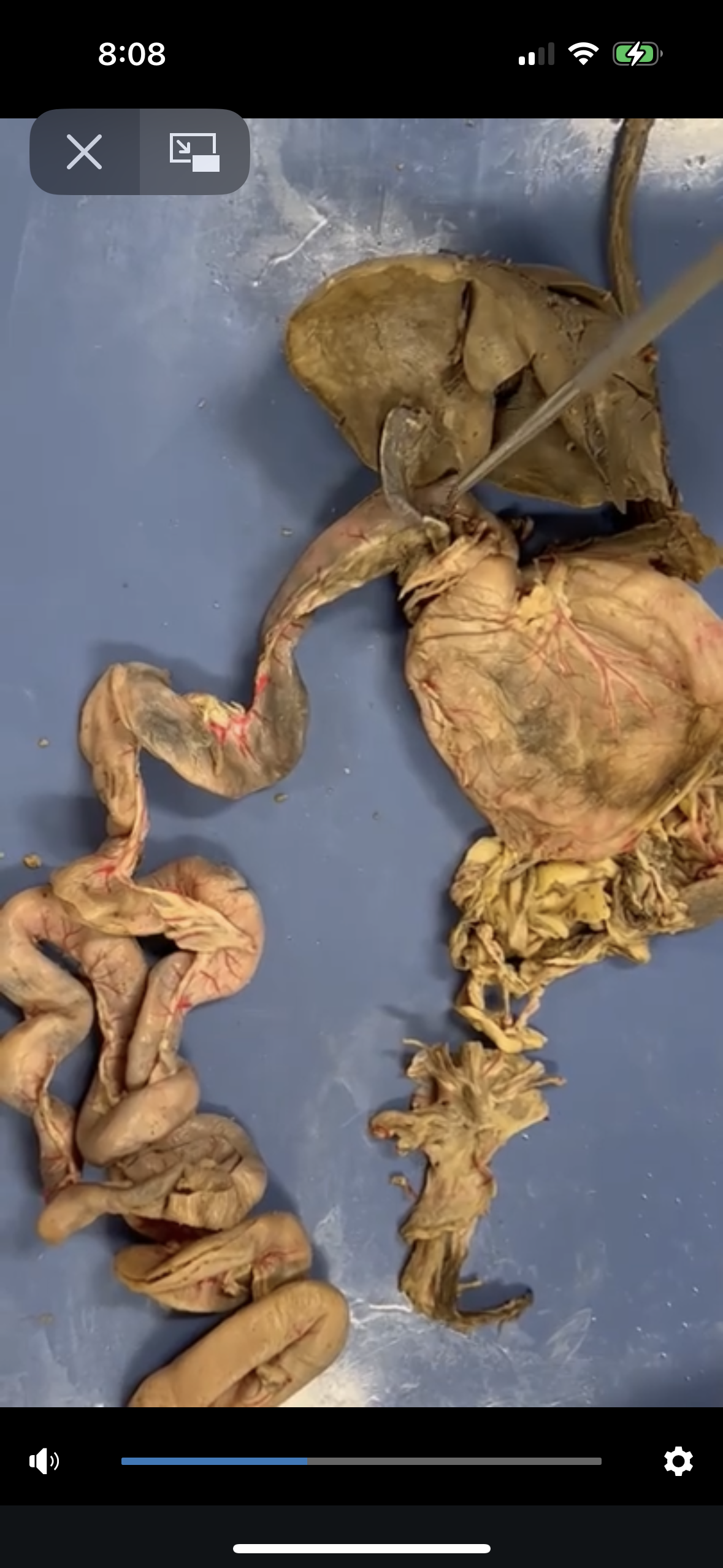 <p>Small Intestines (duodenum, jejunum, ileum its in order)</p>