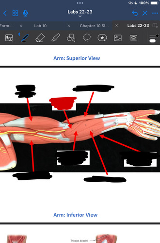 <p>What muscle is this?</p>