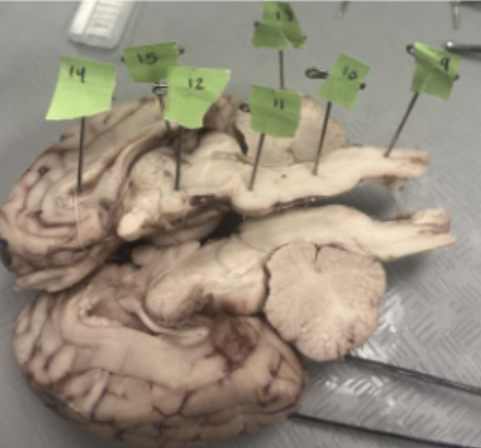 <p>What does number 12 represent on the brain?</p>