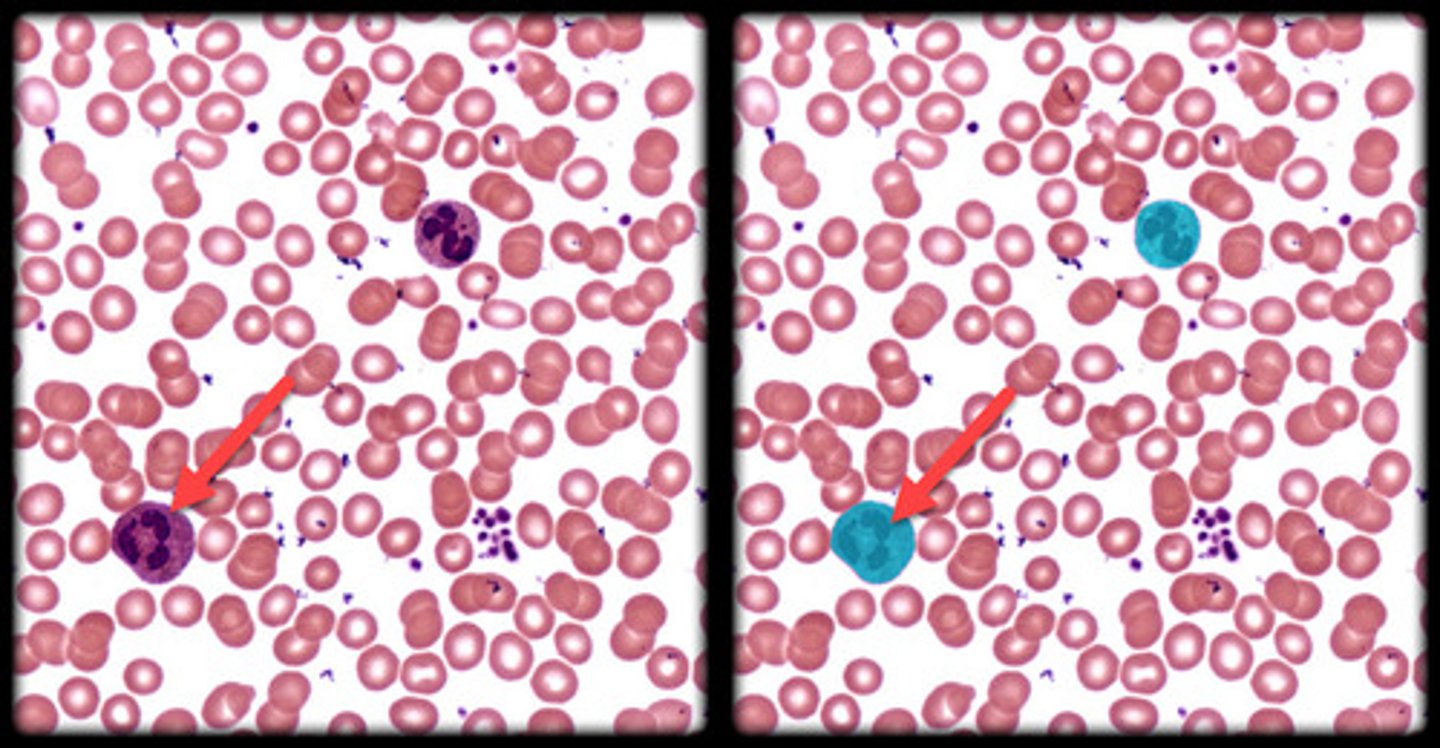 <p>- Larger, irregularly shaped cells with a visible nucleus.</p><p>- Appear darker and larger than erythrocytes, often stained purple or blue.</p>