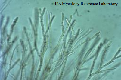 <p>What can mycelium consist of?</p>