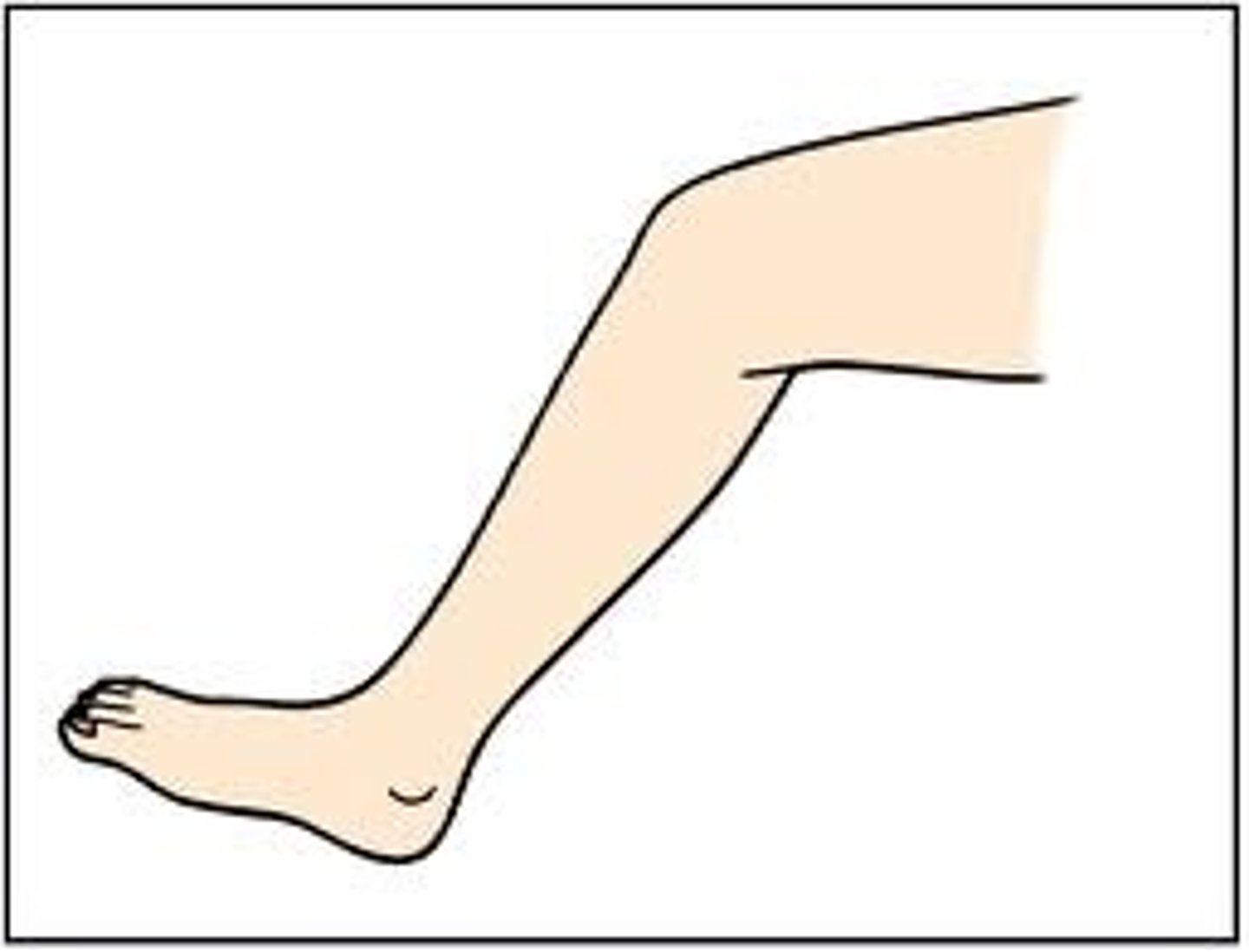 <p>Leg</p>