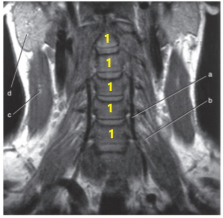 <p>What is # 1's ?</p>