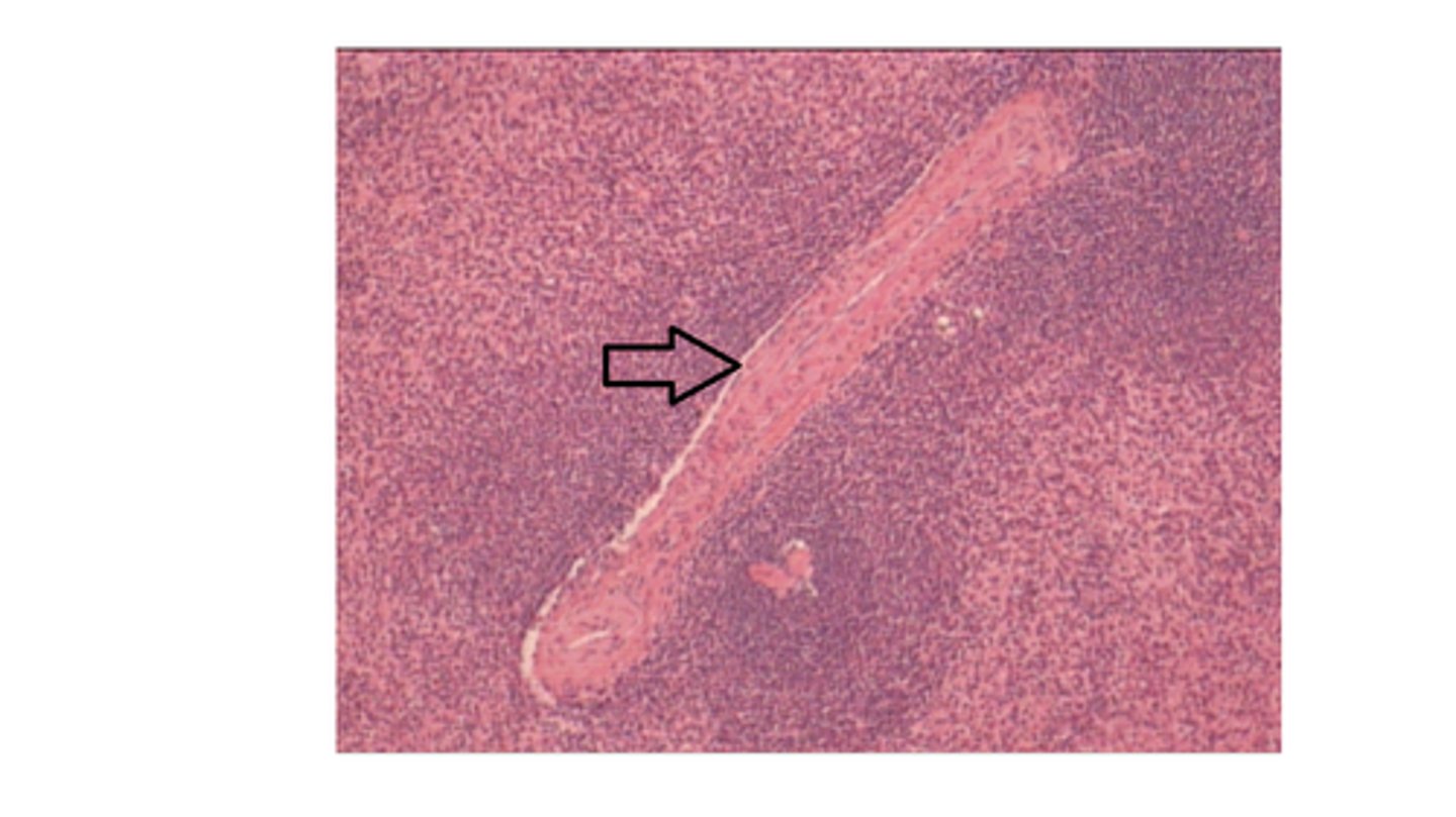 <p>Identify the structure at the arrow?</p>