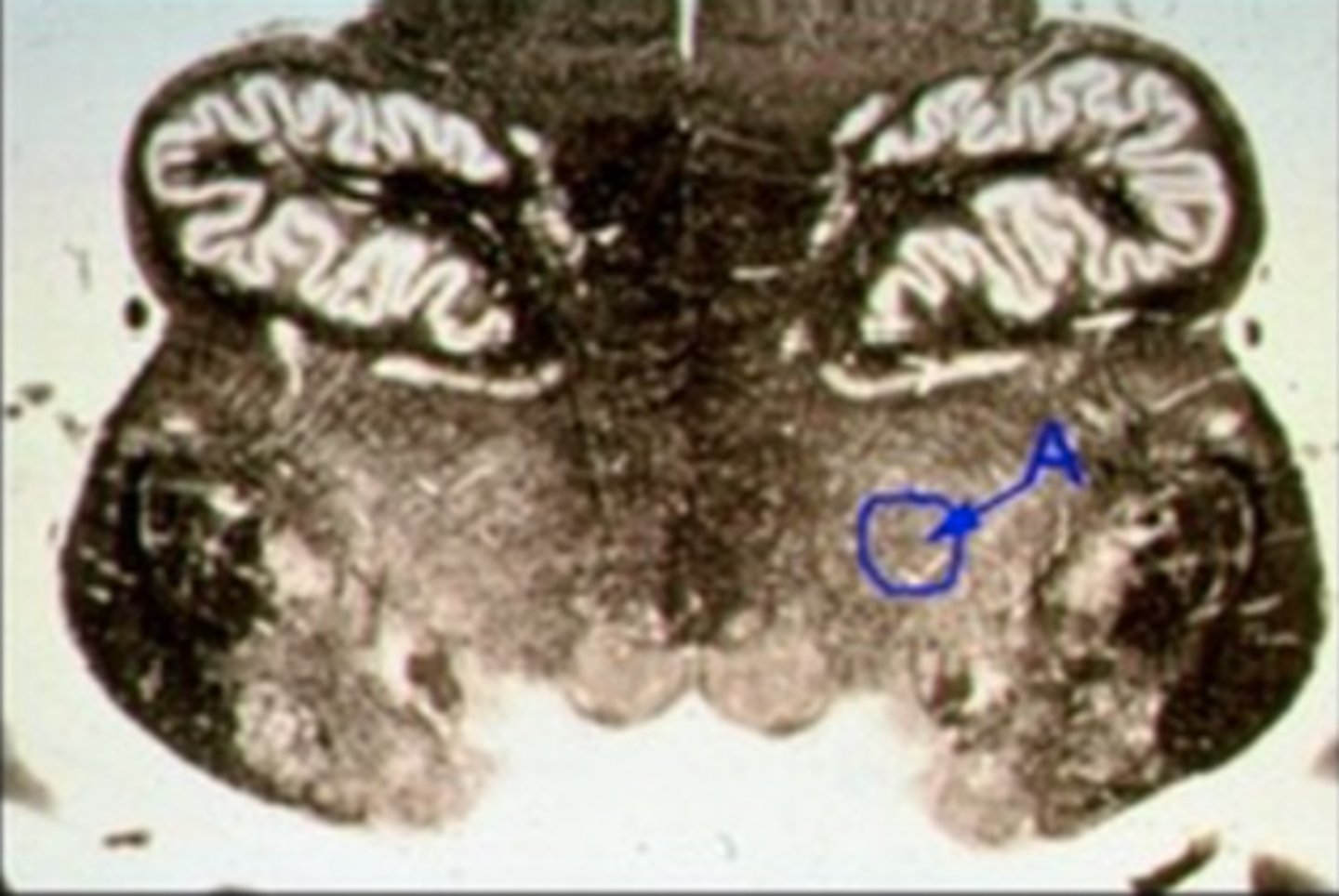 <p>Identify the structure indicated by the outline and letter "A."</p>