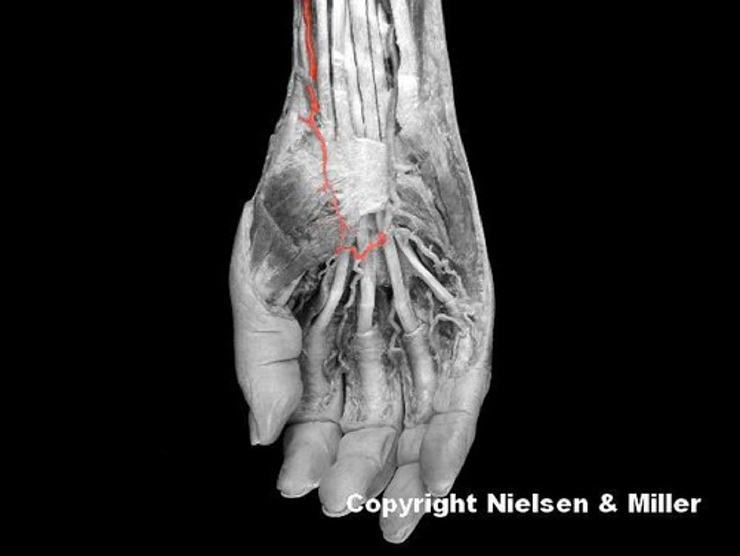 <p>Identify the highlighted vessel.</p>