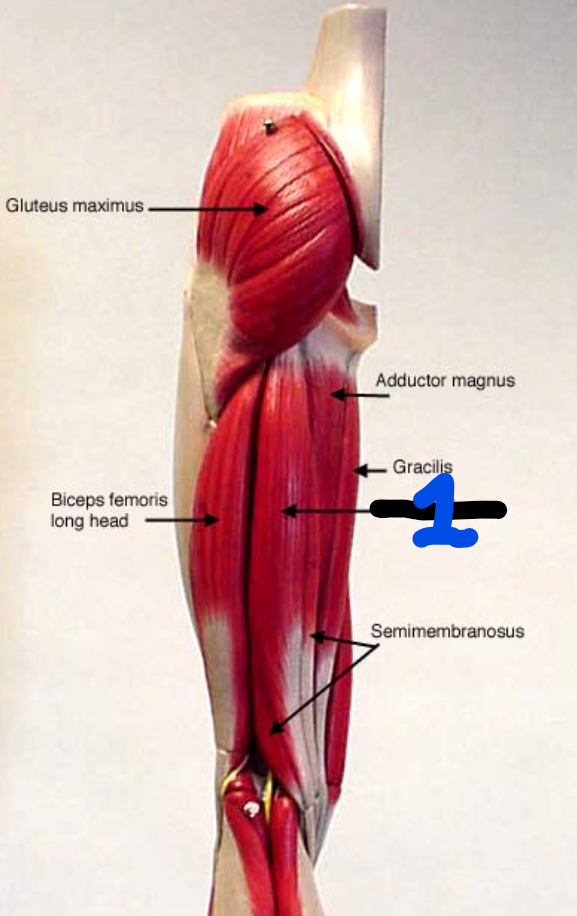 <p><span style="font-family: Arial, sans-serif">What are the 2 actions of this muscle?</span></p>