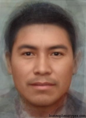 <p>Identify this Phenotype </p>