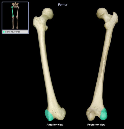 <p>distal end of bone; greater trochanter side</p>