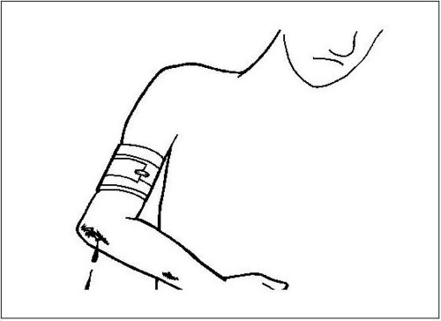 <p>an injury/a wound</p>