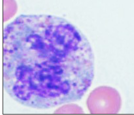 <p>What is this WBC?</p>