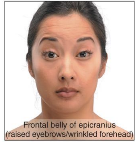 <p><strong>Epicranius - Frontalis- Action</strong></p>