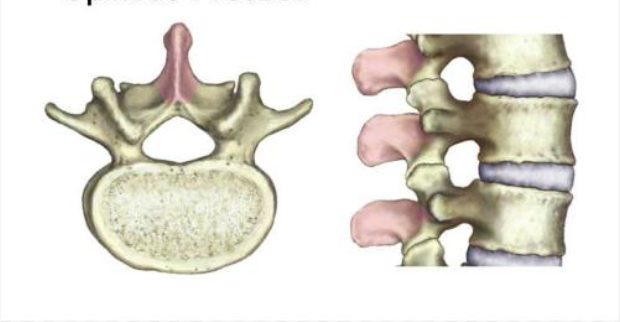 <p>The part of the bone that is connected to the lamina and provides a point of attachment for muscles.</p>