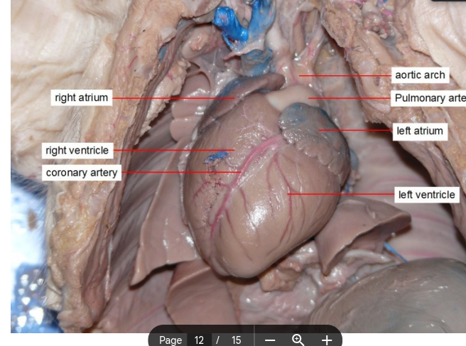 <p>between right atrium and ventricle </p>