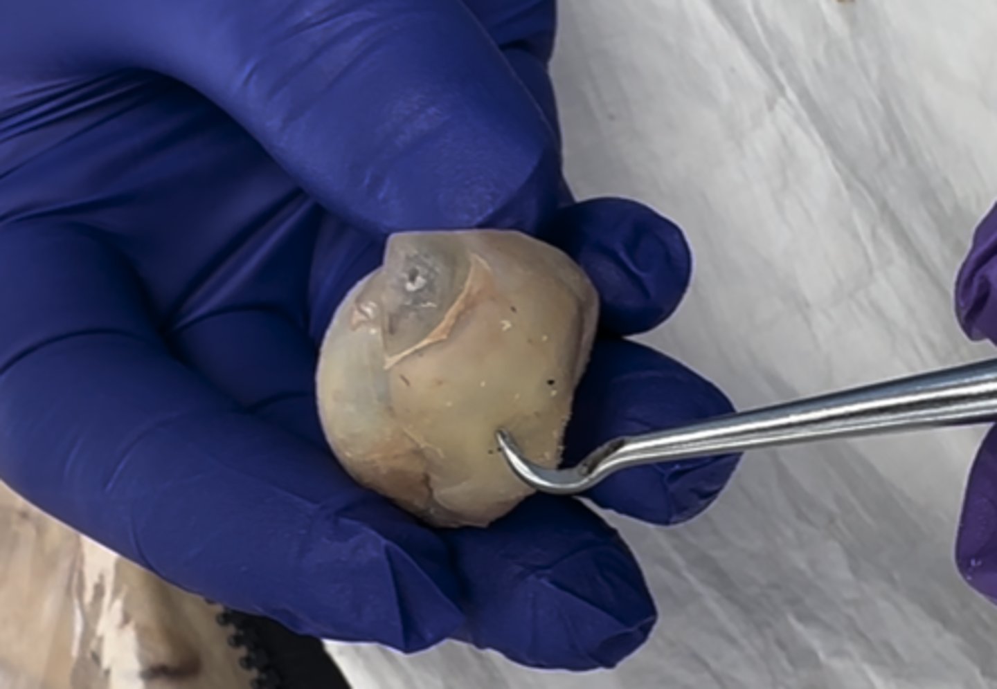 <p>The outer white part of the eye is the</p>