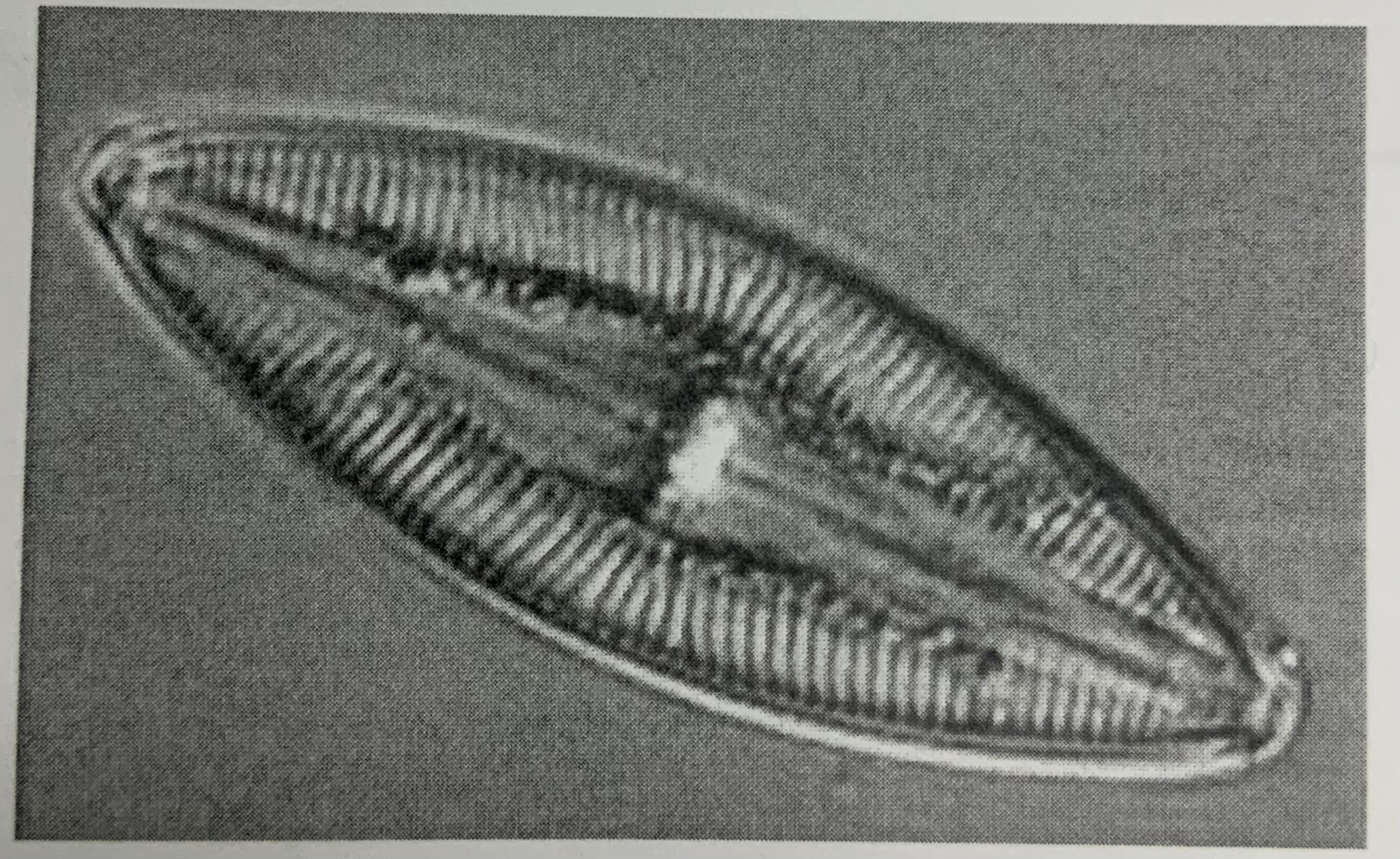 <p>What shape of diatoms are shown below ?</p>