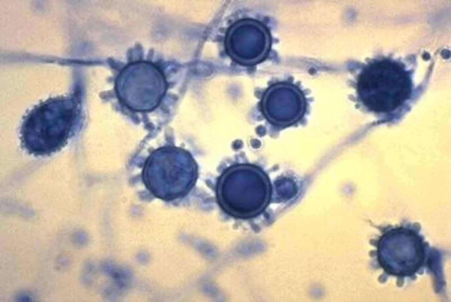 <p>• Small, narrow yeast in tissues</p><p>(easy to confuse with other</p><p>pathogens)</p><p>• Septate, hyaline hyphae with</p><p>spiny macroconidia</p>