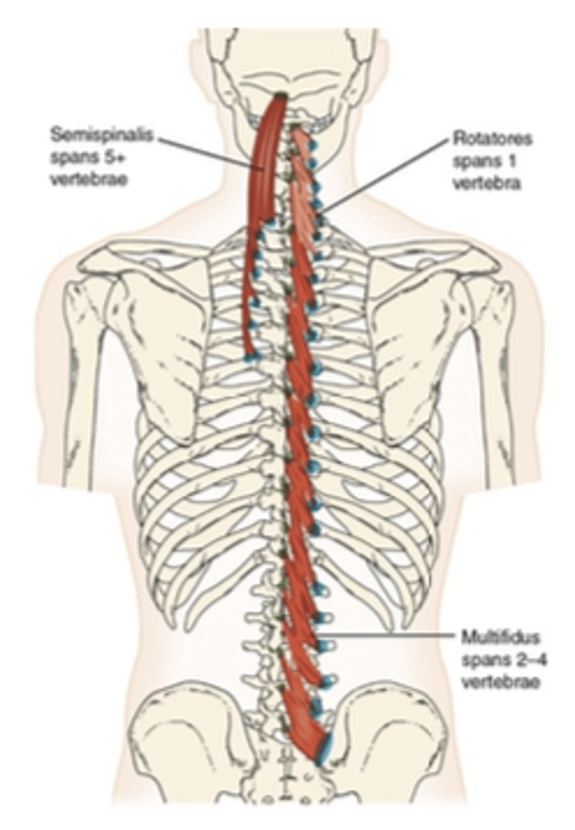 <p>What muscle is this?</p>