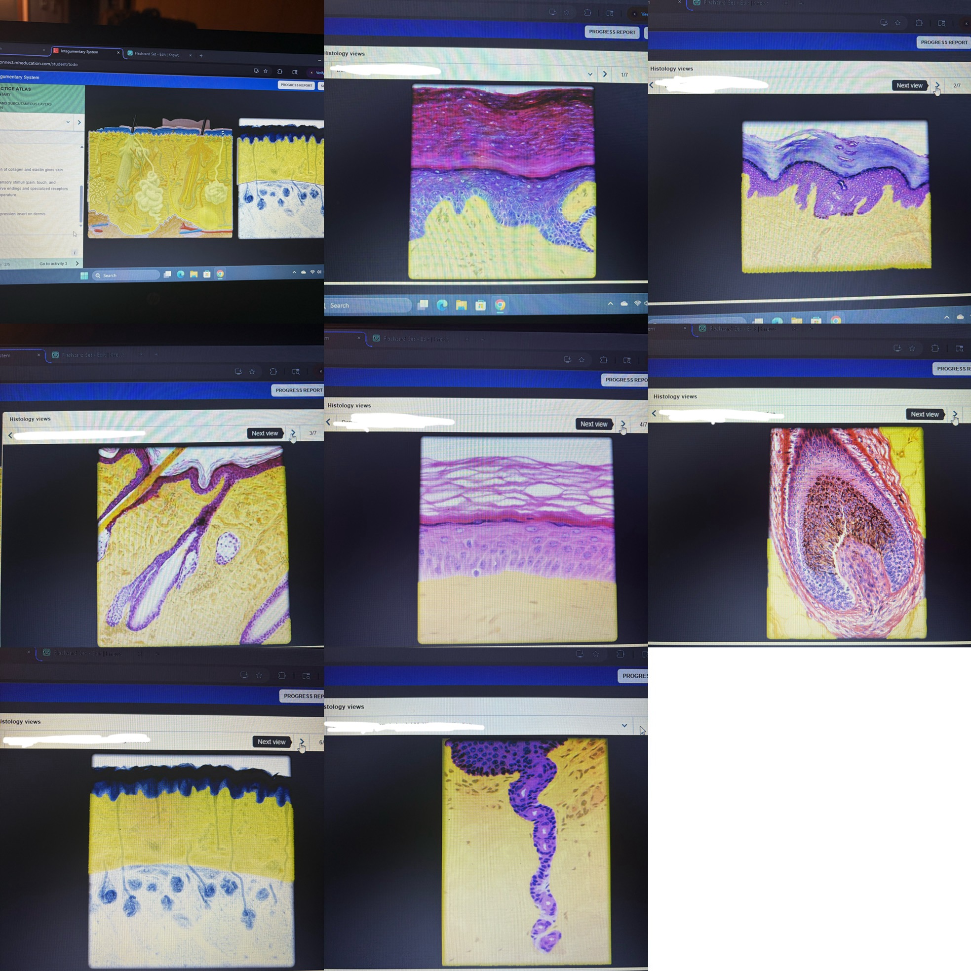 <p>Location- skin (between epidermis and hypodermis)</p>