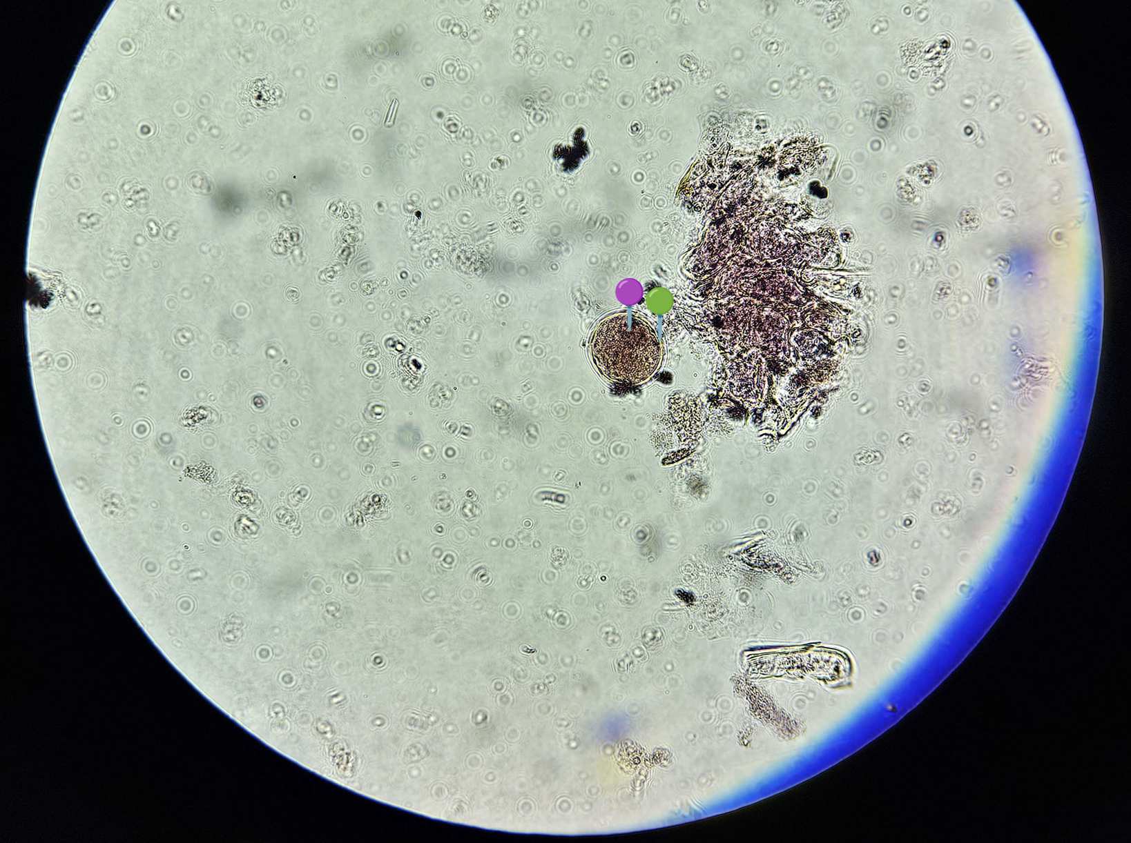 <p><strong><em>Balantidium coli</em></strong></p><p>(Cysta)</p><p></p><p></p><p><strong>Organelle:</strong></p><p></p><ul><li><p><span data-name="red_circle" data-type="emoji">🔴</span><span data-name="yellow_circle" data-type="emoji">🟡</span><span data-name="green_circle" data-type="emoji">🟢</span><span data-name="blue_circle" data-type="emoji">🔵</span><span data-name="purple_circle" data-type="emoji">🟣</span><span data-name="black_circle" data-type="emoji">⚫</span><span>️</span><span data-name="white_circle" data-type="emoji">⚪</span><span data-name="brown_circle" data-type="emoji">🟤</span></p></li></ul><p></p><ul><li><p><span data-name="red_circle" data-type="emoji">🔴</span><span data-name="yellow_circle" data-type="emoji">🟡</span><span data-name="green_circle" data-type="emoji">🟢</span><span data-name="blue_circle" data-type="emoji">🔵</span><span data-name="purple_circle" data-type="emoji">🟣</span><span data-name="black_circle" data-type="emoji">⚫</span><span>️</span><span data-name="white_circle" data-type="emoji">⚪</span><span data-name="brown_circle" data-type="emoji">🟤</span></p></li></ul><p></p><p></p><p><strong>Parazytoza:</strong> <em>Balantydioza</em></p>