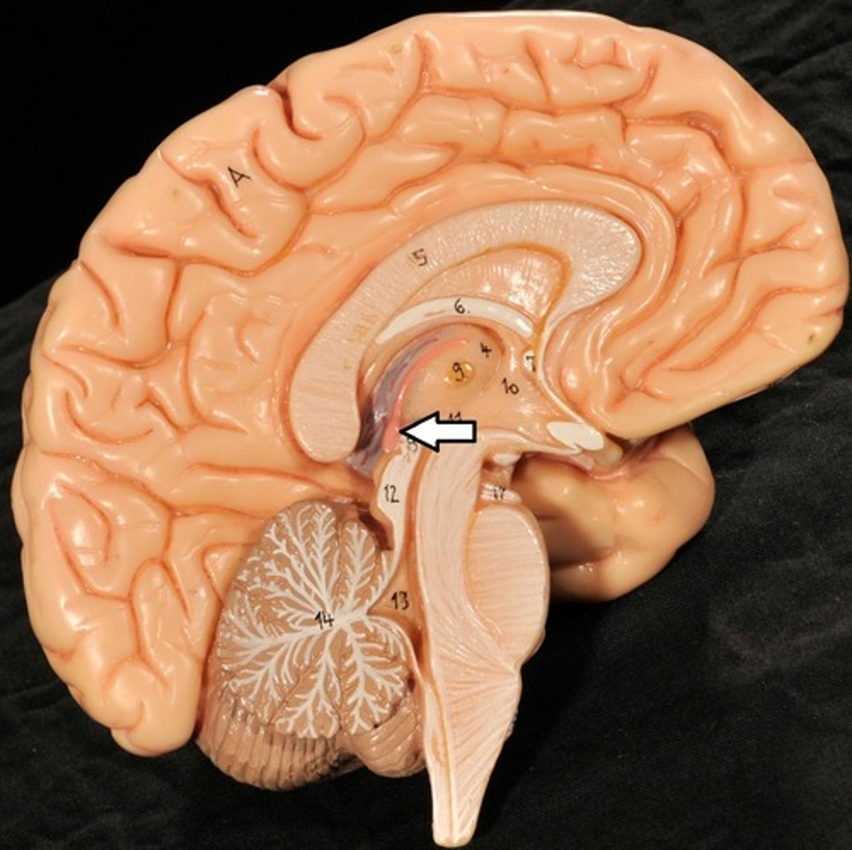 <p>Forms the roof of the 3rd ventricle,</p><p>Houses the pineal gland or body (an endocrine gland) (Melatonin production: sleep/wake cycle),</p><p>Includes the choroid plexus (forms cerebrospinal fluid- CSF)</p>