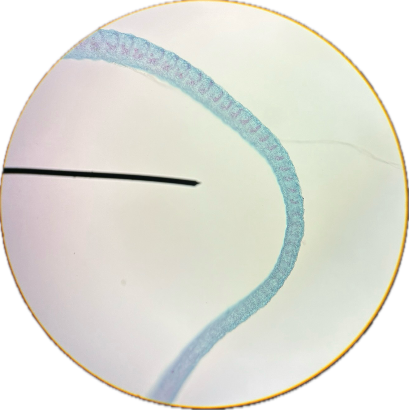 <p>Proglottids are wider than long, the genital pores unilateral, and there are three testes per segments. </p>