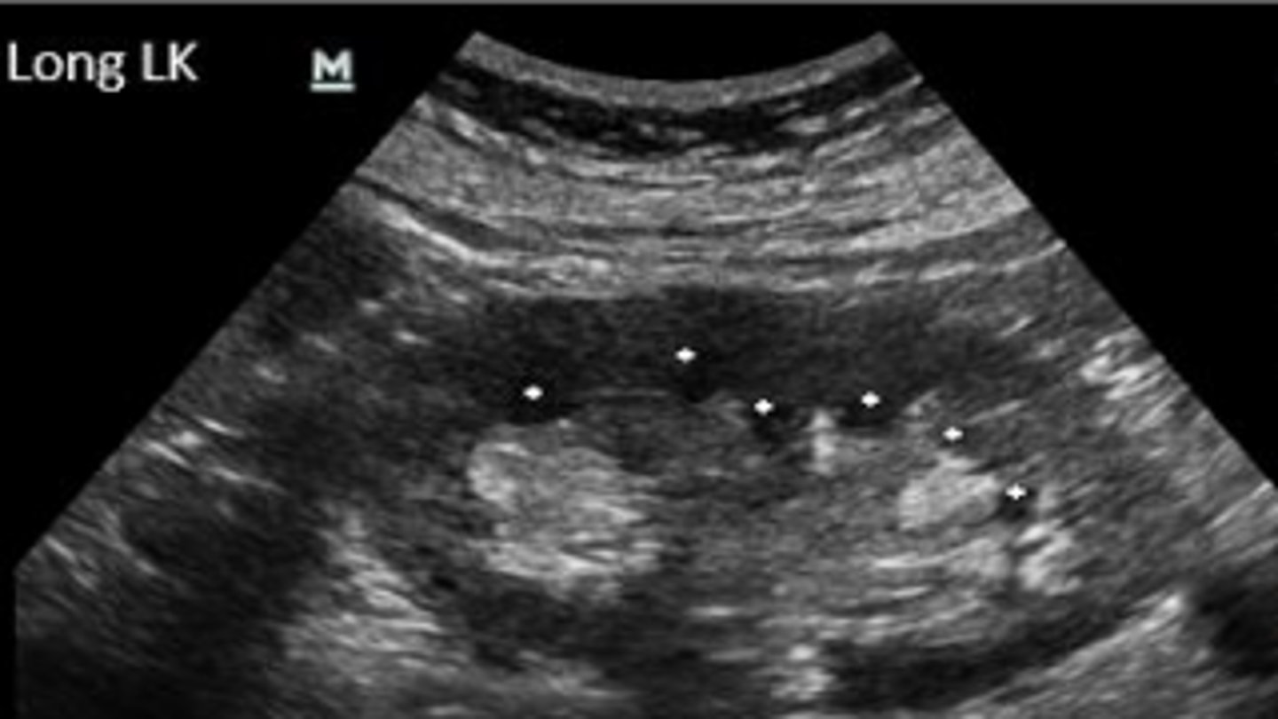 <p>The dots indicate:</p>