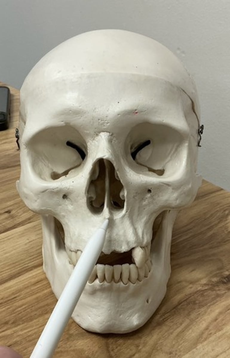 <p>What is being pointed to?</p>