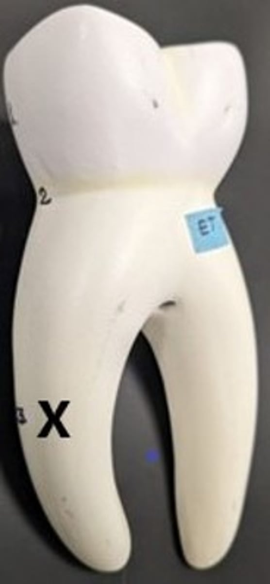 <p>ID the External Tooth Region</p>