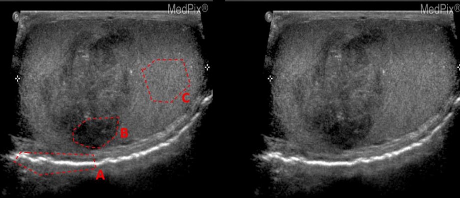 <p>State the ultrasound phenomena in the indicated area (specular reflection, transmission, scattering, enhancement, shadowing)</p>