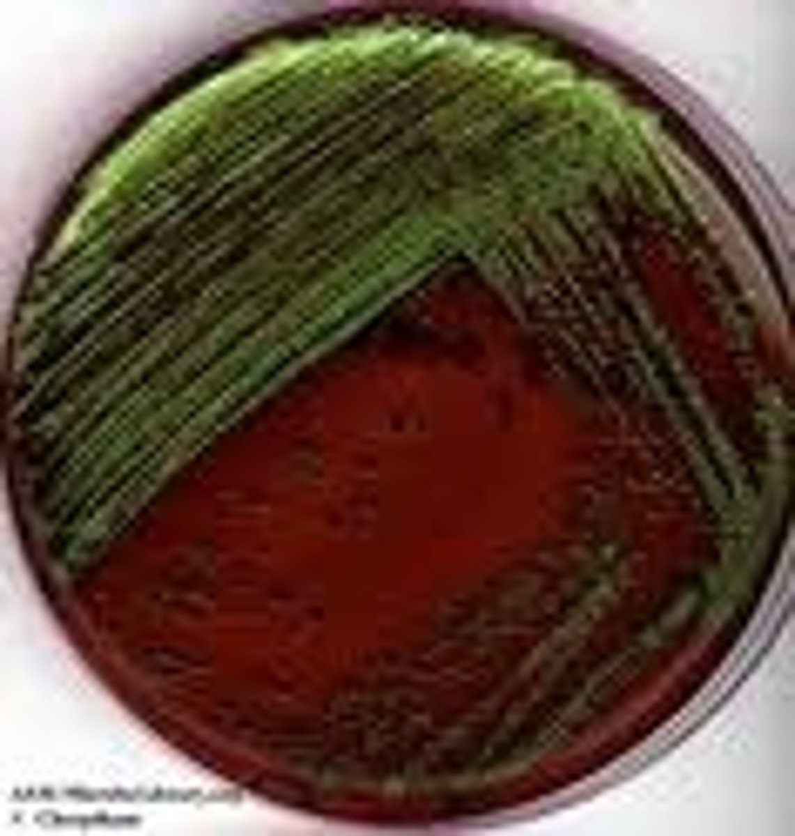 <p>Identify Pathogen causing Diarrhea:</p><p>Gram-negative rod</p><p>-Hx:</p><p>&gt; MCC of Traveler's Diarrhea</p><p>&gt; Fecal-Oral Route (Contaminated food/water)</p><p>-Path:</p><p>&gt; Heat-labile Toxin = activates cAMP --&gt; Cl secretion --&gt; Water in Gut</p><p>&gt; Heat stable Toxin = activates cGMP --&gt; Cl secretion --&gt; Water in Gut</p><p>-Sx/PE:</p><p>&gt; Watery (Non-Inflammatory) Diarrhea</p><p>&gt; Cramps</p><p>&gt; No Fever OR Low-Grade Fever</p><p>-Dx:</p><p>(+) Lactose on EMB</p>