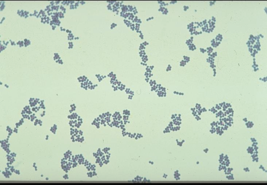 <p><span style="color: purple;"><strong><span>GP cocci</span></strong></span><strong> in grape-like clusters, 0.7-15 µm</strong></p>