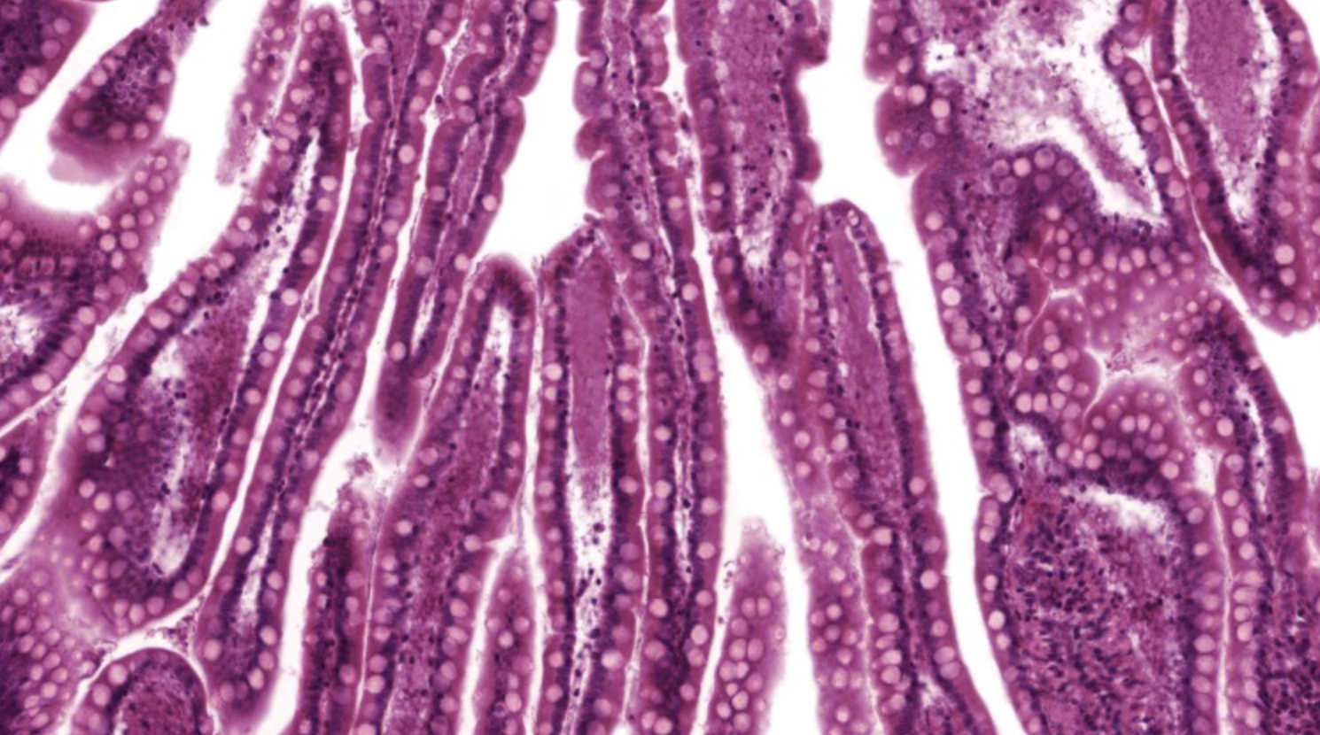 <p>Villi in Ileum</p>