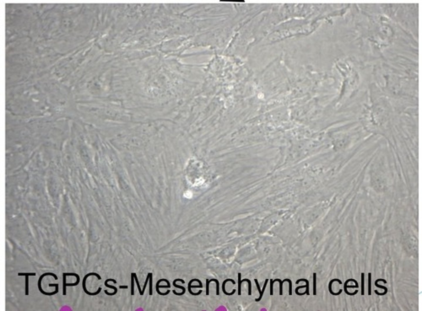 <p>mesenchymal tooth germ progenitor cells (TGPCs)</p>