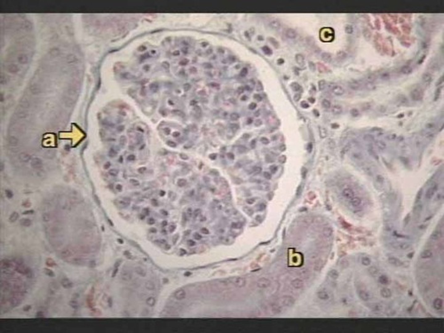 <p>Identify this urinary system structure (a).</p>