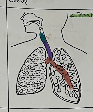 <p>Larynx, Trachea &amp; Bronchi</p>