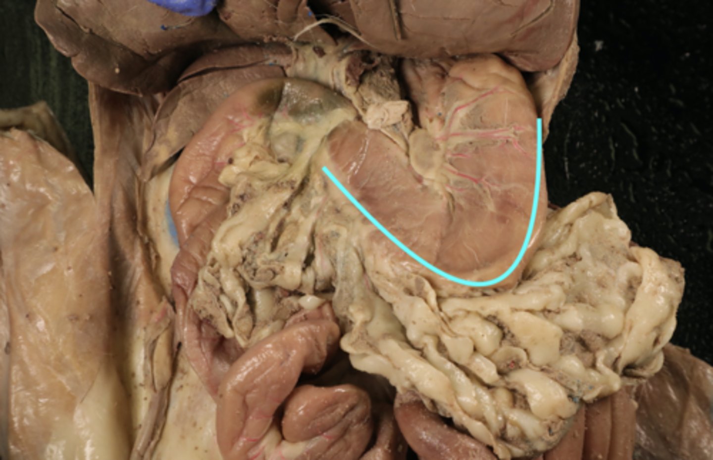 <p>name this part of the organ</p>