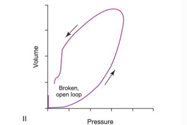 <p>What does this loop indicate?</p>