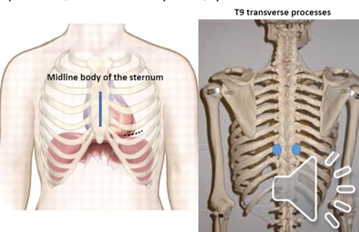 <p>anterior point: midline, body of sternum<br>posterior point: T9 transverse processes</p>