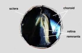 <p><span style="background-color: transparent;">Choroid</span></p>