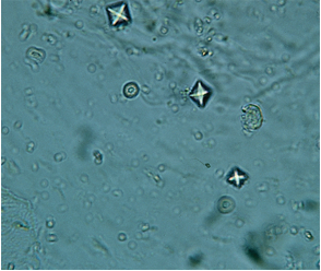 <p>-Small square crystals with Central cross</p><p><strong>MC</strong> stone type</p>