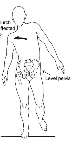 <p><strong>What is Trendelenburg’s Gait?</strong></p>