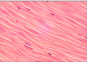 <p>covering wall of internal organs; no striations, involuntary.</p>