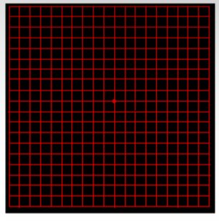 <p>What disease can this amsler chart detect</p>